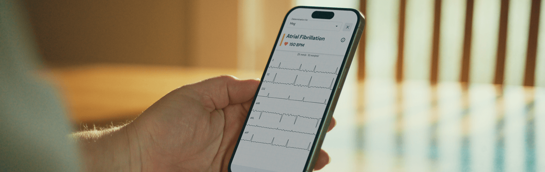 /what-is-afib-4