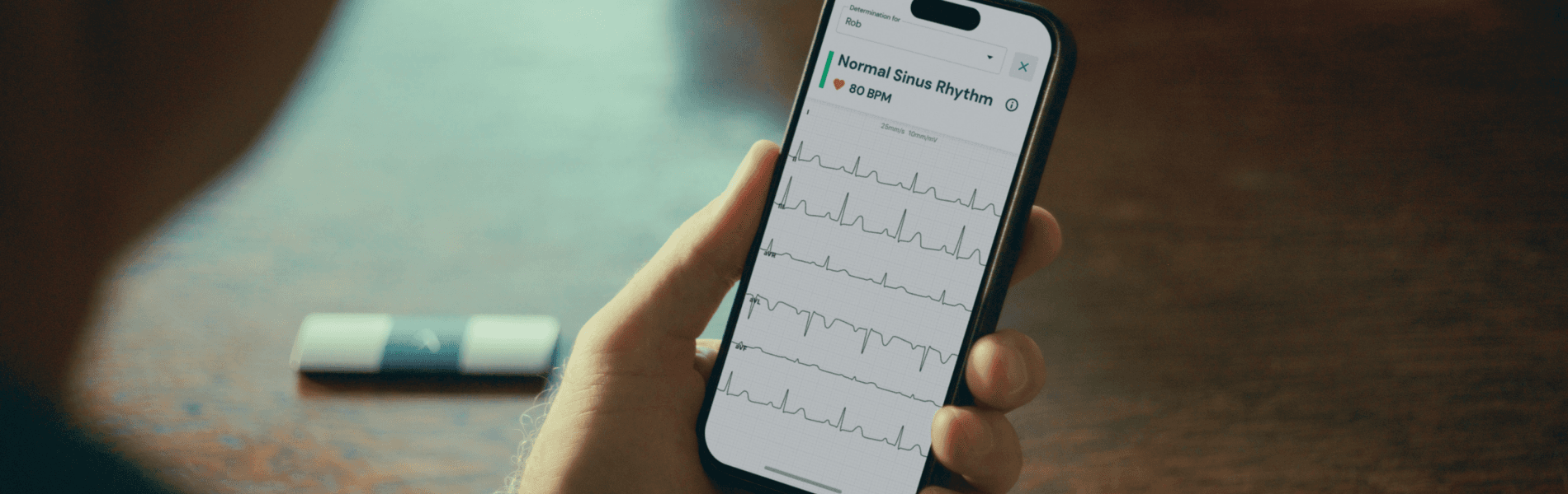 /what-is-an-ekg-4