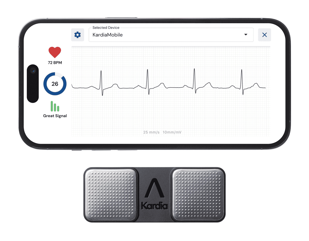 Record an EKG in seconds