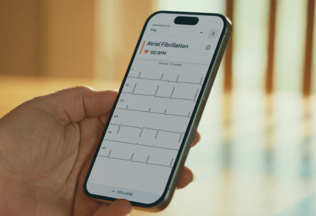 /what-is-afib-2