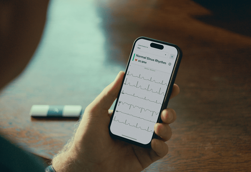 /what-is-an-ekg-2